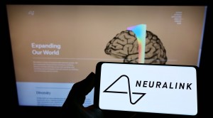 FDA Approved Neuralink's Application for Human Trials